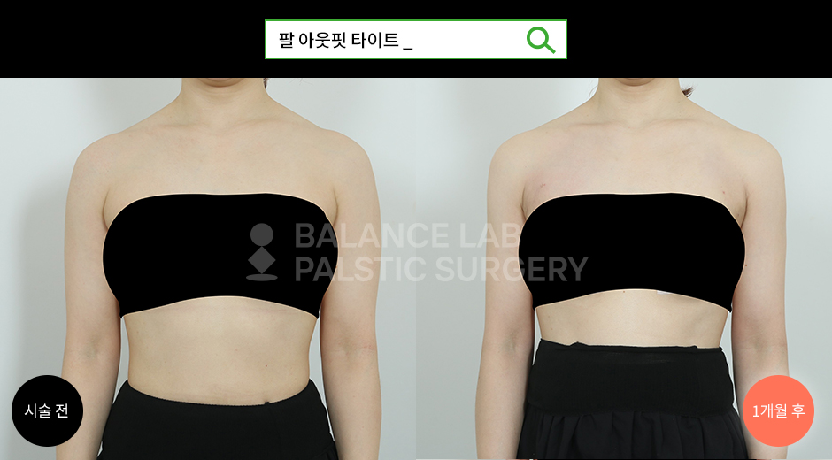 Before 3 Front