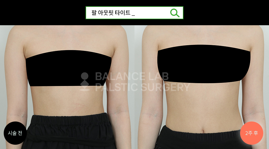 Before 3 Front