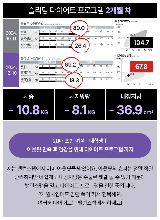 관리