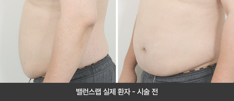 관리