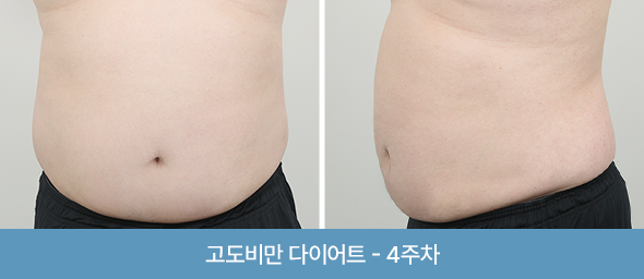 관리