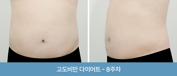 관리