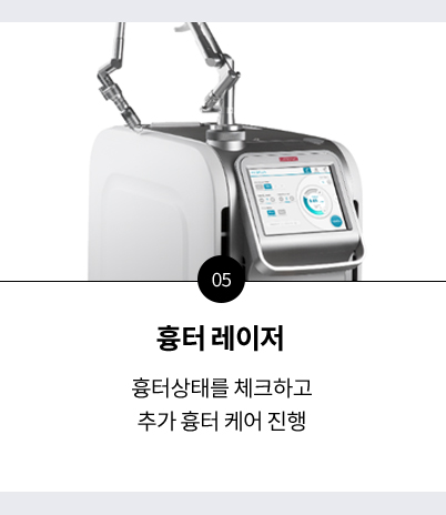 관리