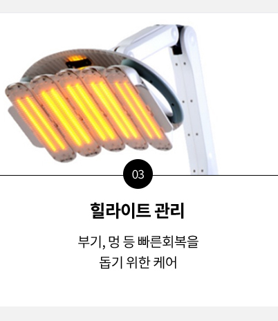 관리
