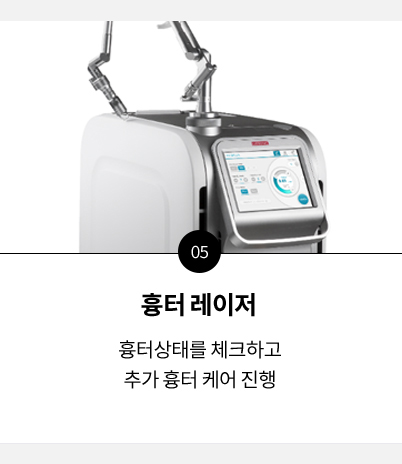 관리